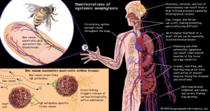 The-Connection-Between-Pests-and-Allergies-Including-How-to-Manage-Allergy-Symptoms-Caused-by-Pests